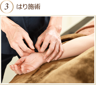 はり施術