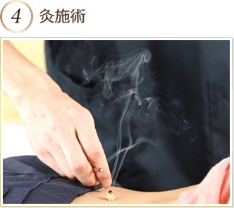 灸施術